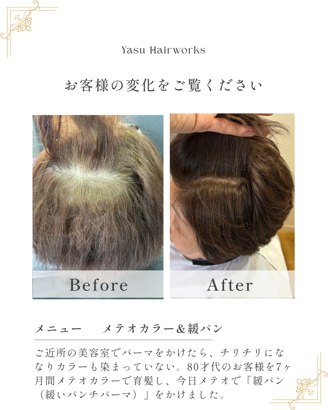 近所の美容室でパーマ失敗→7ヶ月間メテオカラーで育髪し緩パン施術（ビフォーアフター）